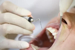 How Periodontics Enhances The Success Of Cosmetic Dental Procedures